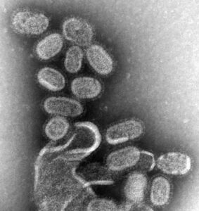 इन्फ्लूएंजा वायरस