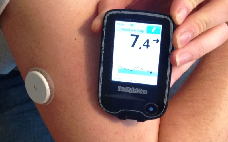 Continuous Glucose Monitor