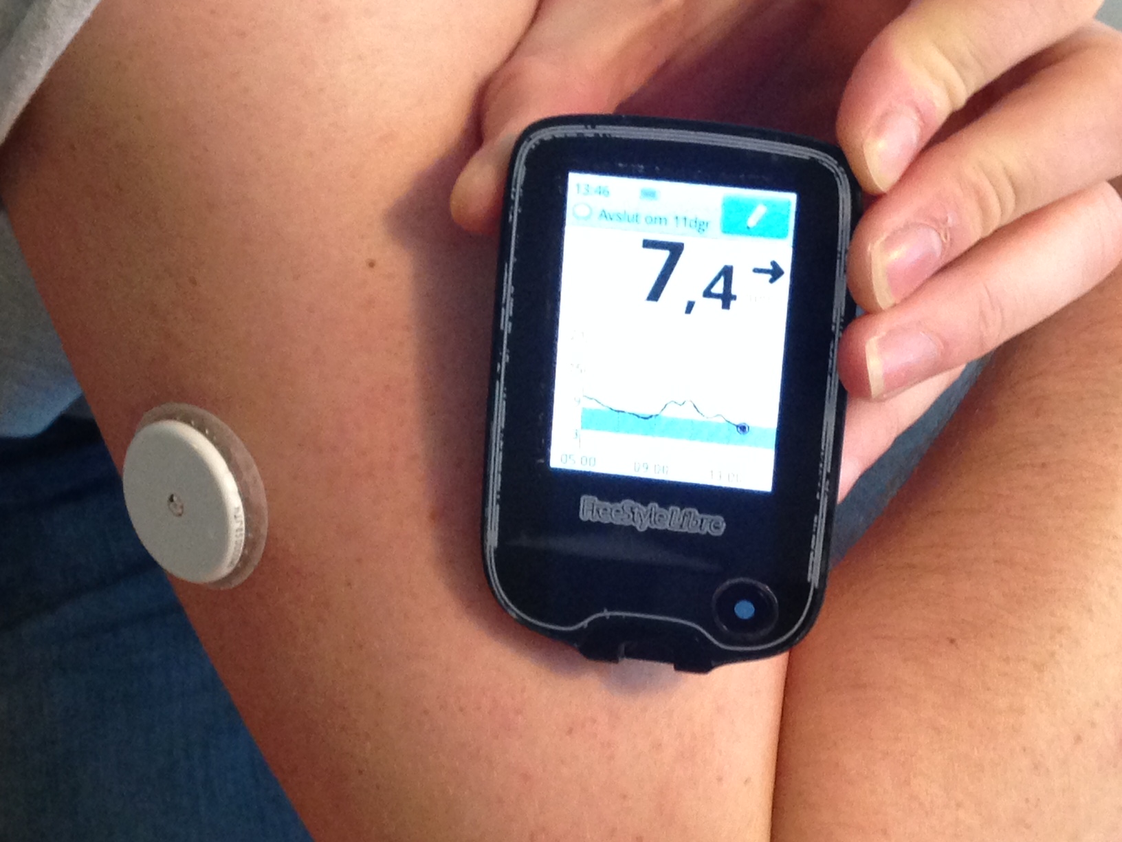 when were the Continuous Glucose Monitor (CGM) Coverage